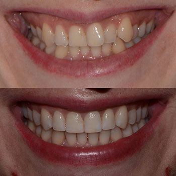 Before and After Gallery Photo Before and After Gallery Photo