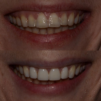 Before and After Gallery Photo Before and After Gallery Photo