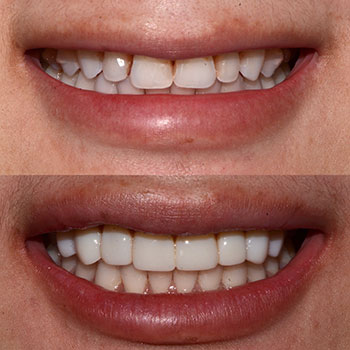 Before and After Gallery Photo Before and After Gallery Photo