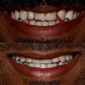 Before and After Gallery Photo