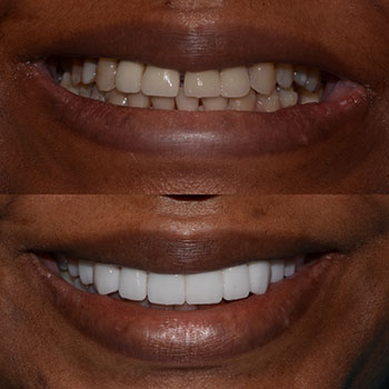 Before and After Gallery Photo