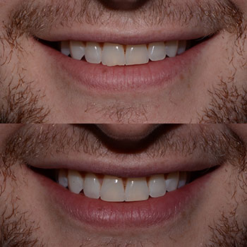 Before and After Gallery Photo Before and After Gallery Photo