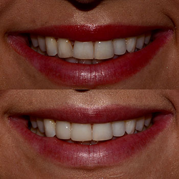 Before and After Gallery Photo