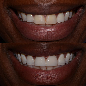 Before and After Gallery Photo