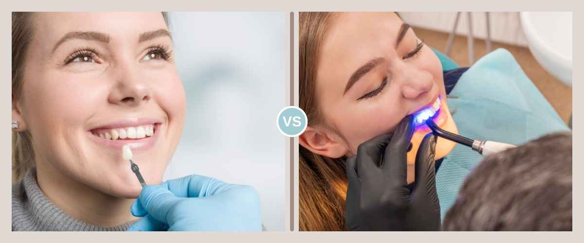 Composite Bonding vs. Porcelain Veneers: Pros, Cons, and How to Choose